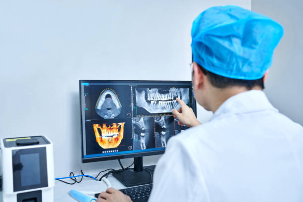 Best Emergency Tooth Extraction in Munford, AL